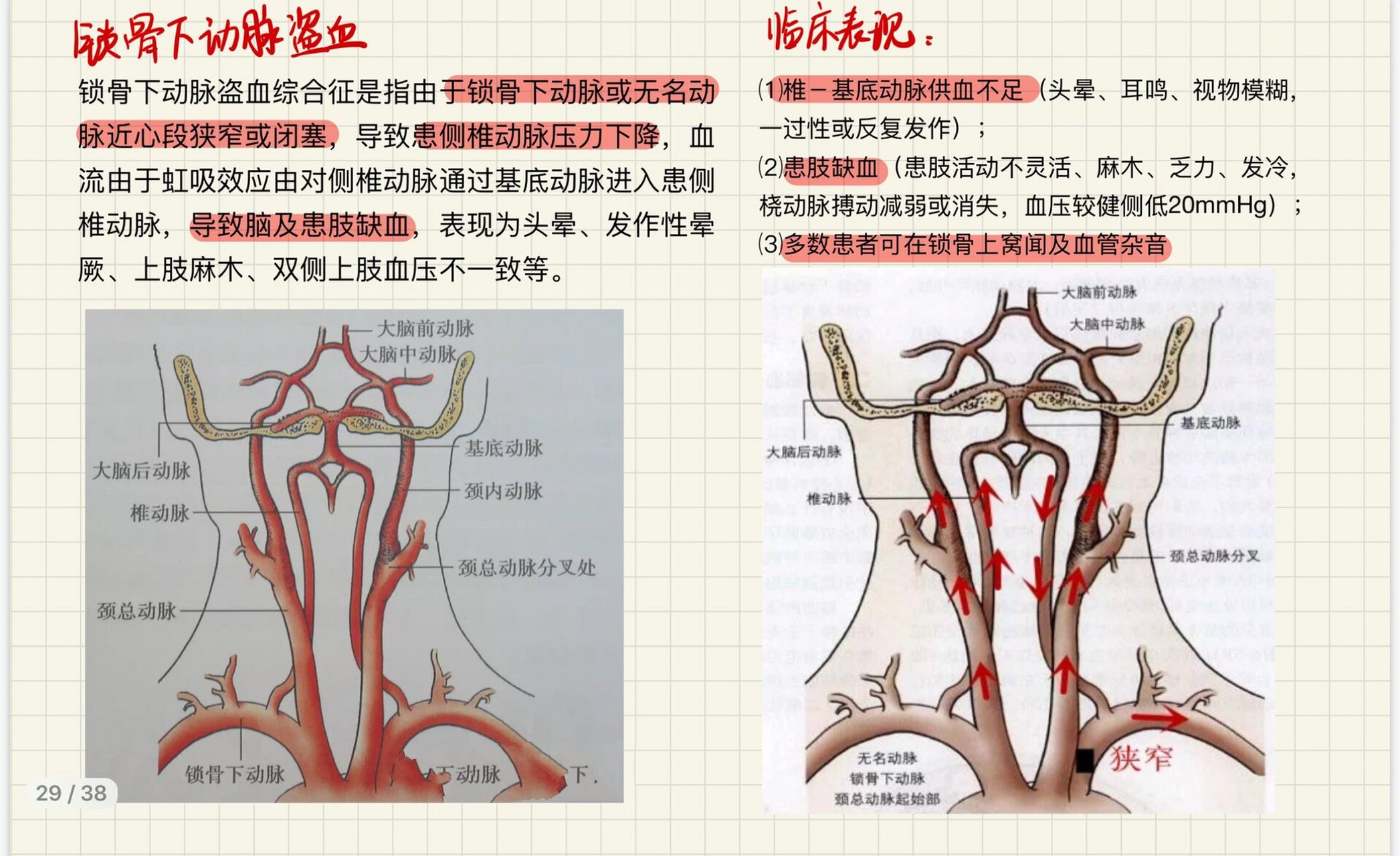 锁骨下动脉分段的标志图片