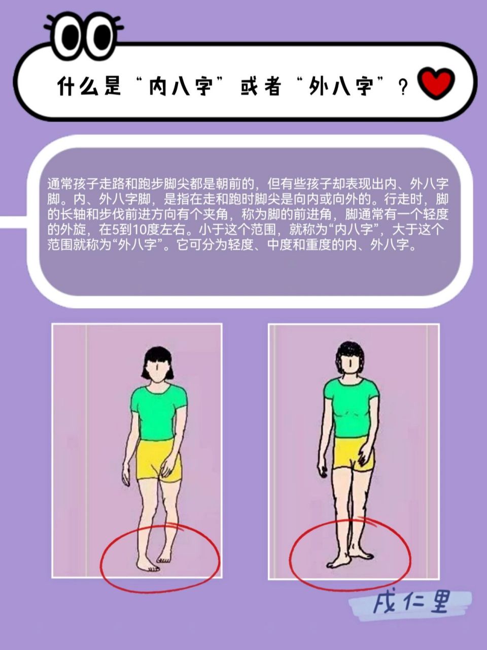 有没有出现内八或者外八这种状况0198 快来康康07 内外八字脚和
