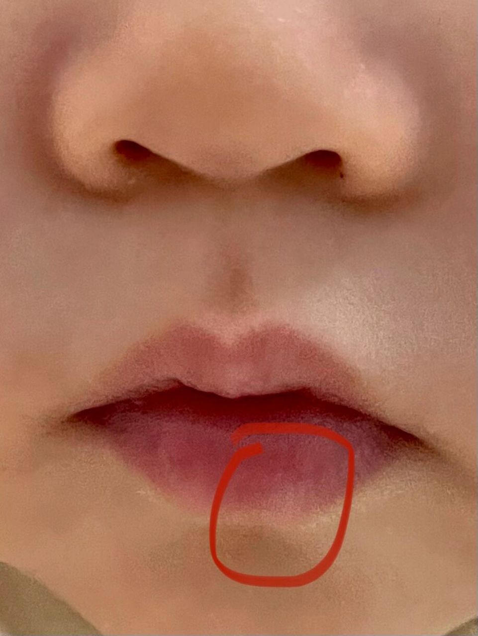 婴儿嘴唇上一块白色圆圆的 万能的有人知道怎么回事吗?