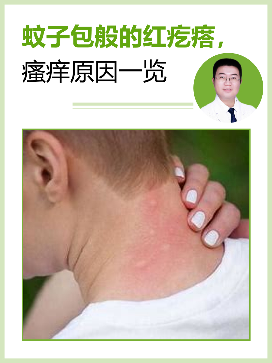  最近的蚊子怎么叮得这么痒(蚊子咬了会传染什么病)