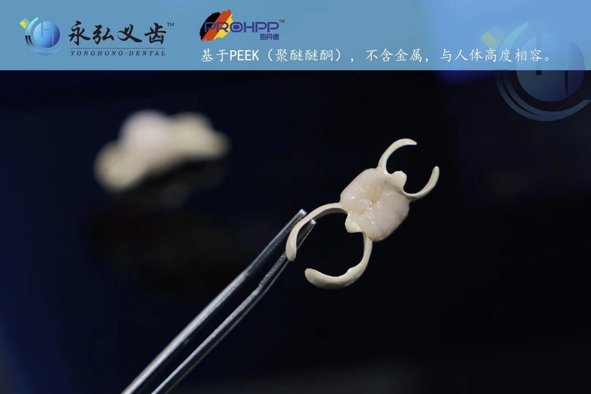 hpp粘接桥 hpp粘接桥一种隐形固定粘接桥,不磨牙修复固定患者的福音