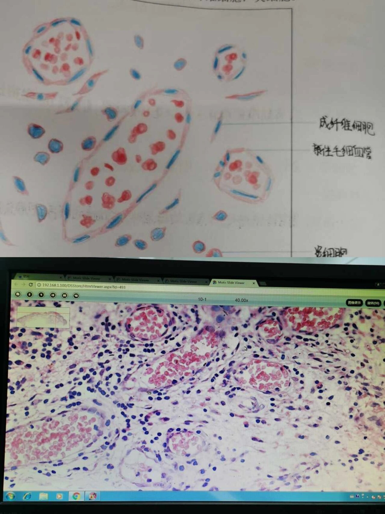 假小叶实验报告手绘图图片