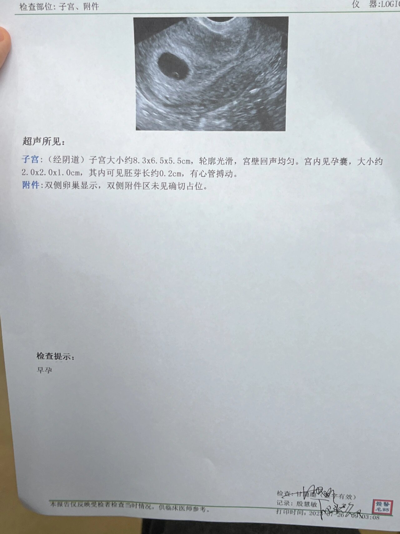 第一张图是5周5天的,胎芽2mm有胎心就没管了.