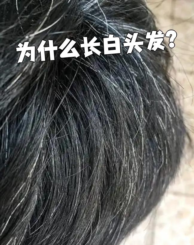 为什么有白头发 为什么有白头发