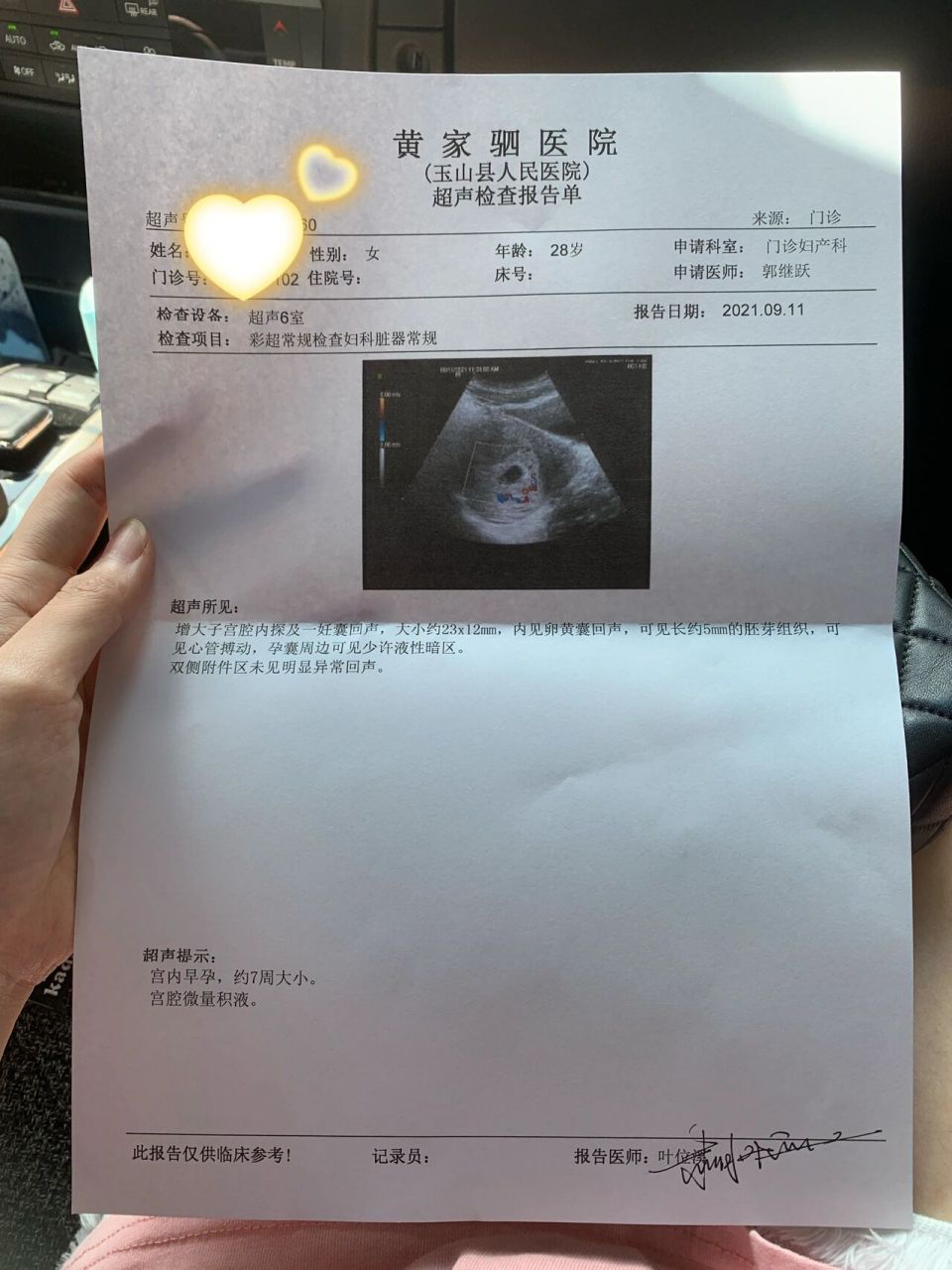 怀孕5周的彩超图片图片