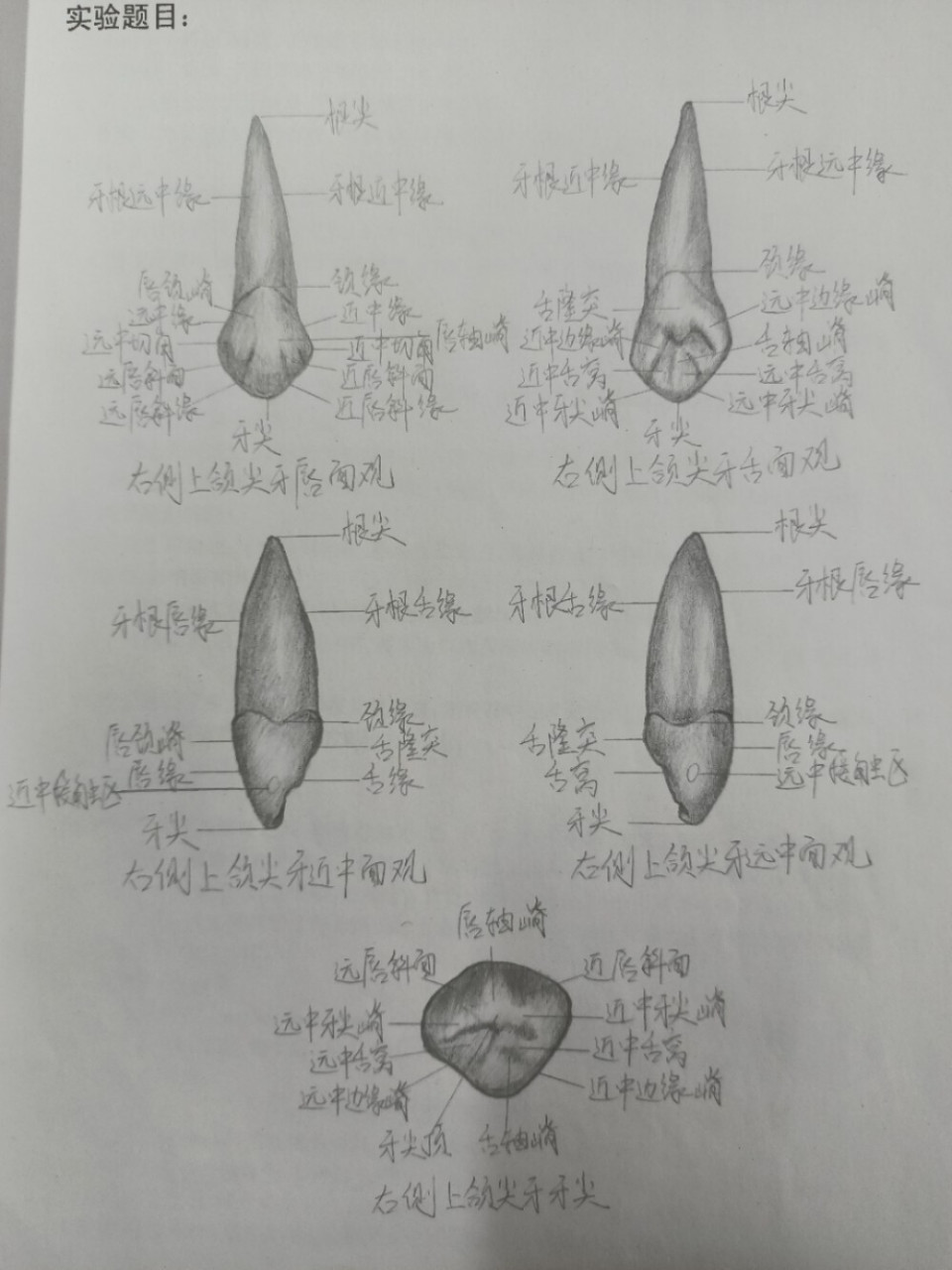 第二弹 口腔解剖生理学尖牙 上次发了中切牙,这次又有了新作业尖牙