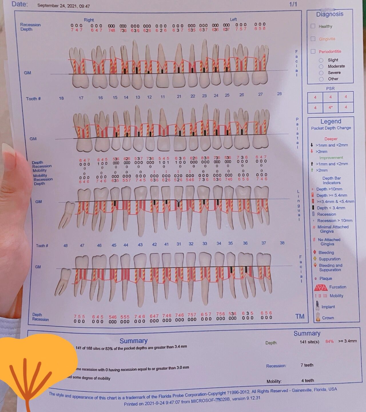 牙周探针刻度表示多少图片