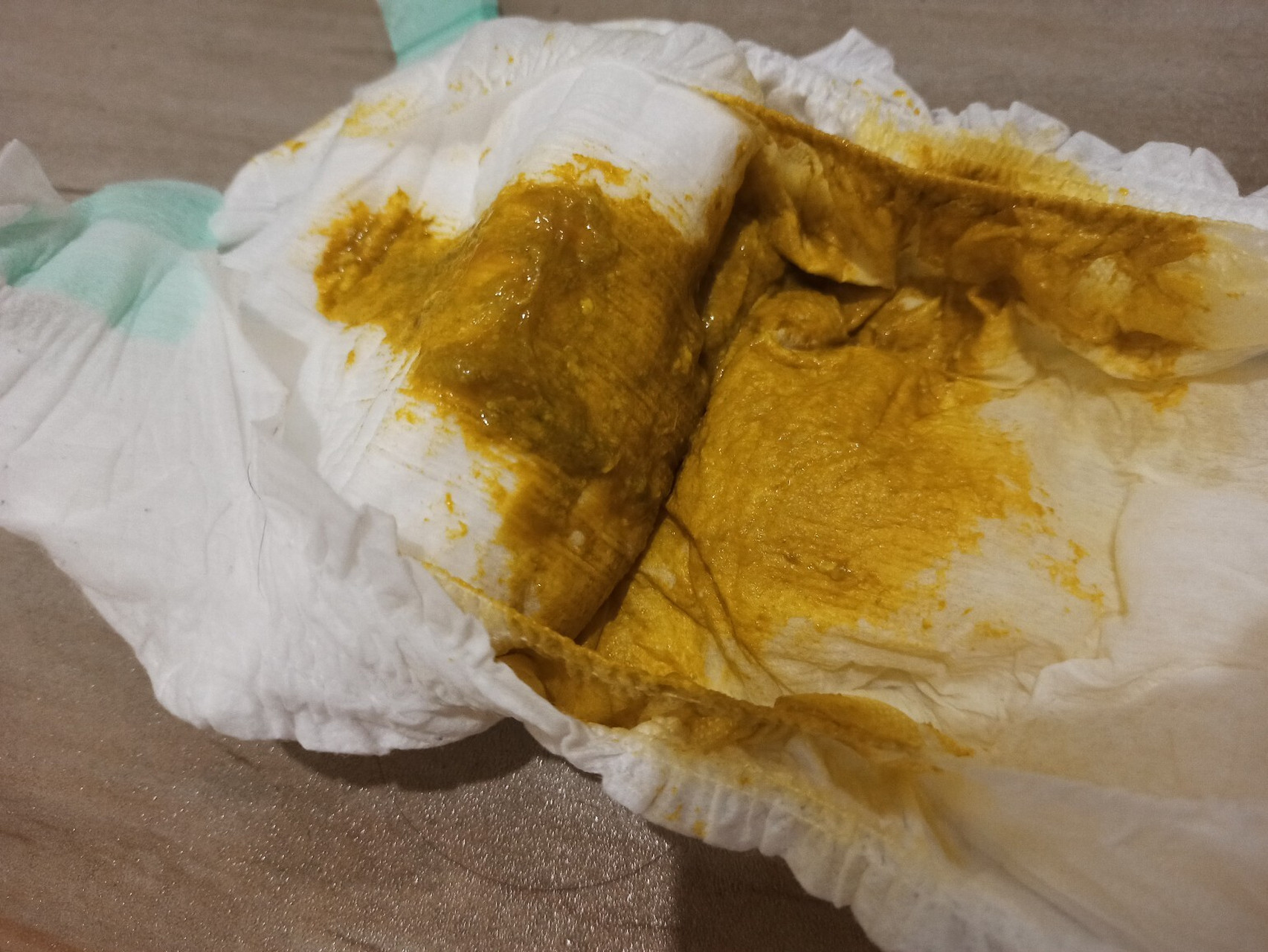 粘液便 宝宝还有10天就6个月了,本来已经是一天一两次的带糊状的粑粑