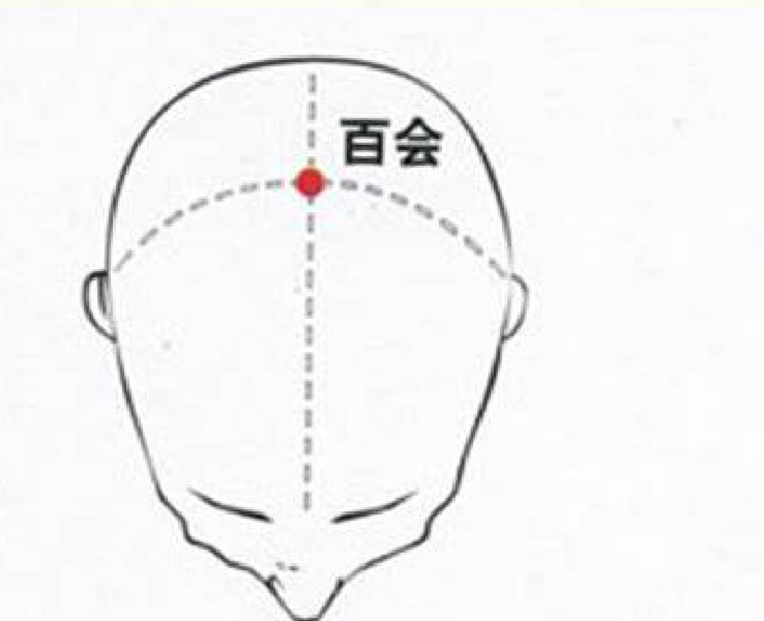 百会位置图片