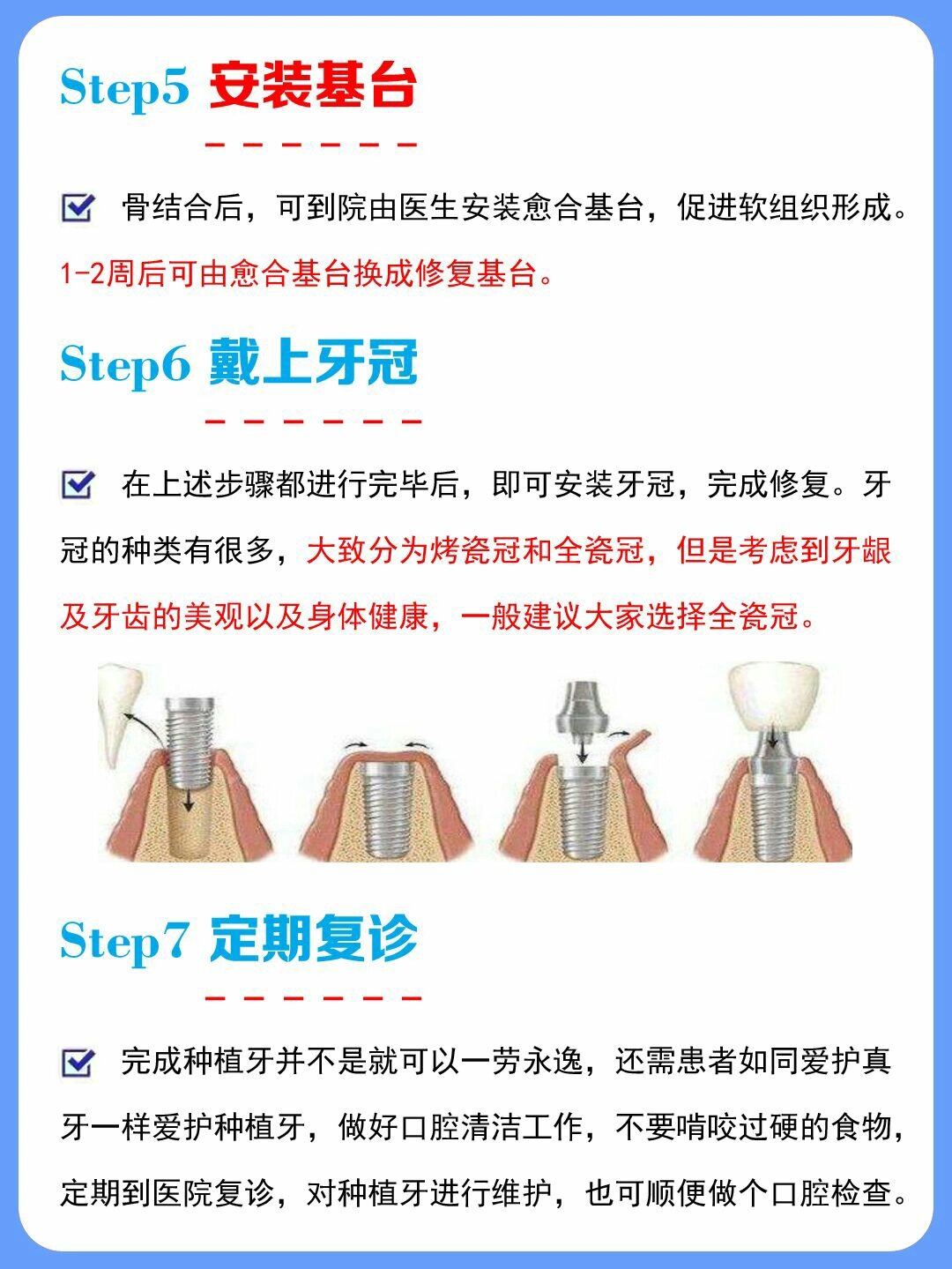 7个步骤了解种植牙种植全过程 牙齿,在我们生活中是密不可分的,一口好