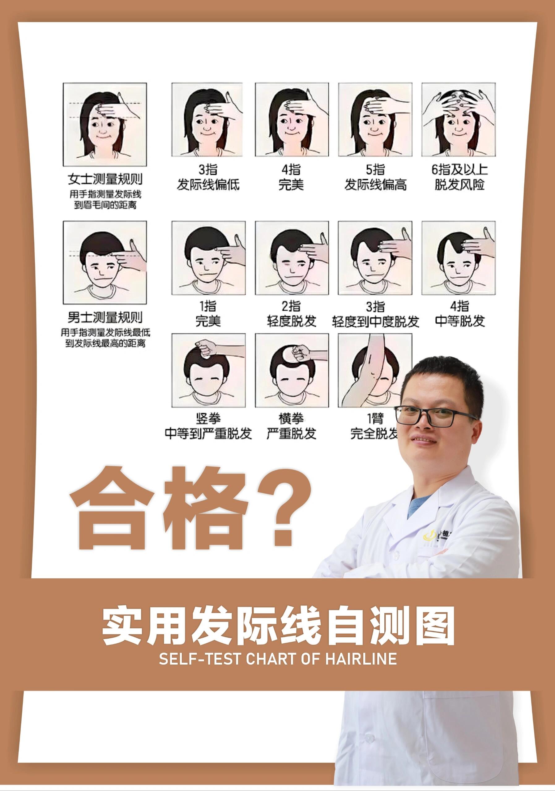 发际线自测图 经常有发友问我