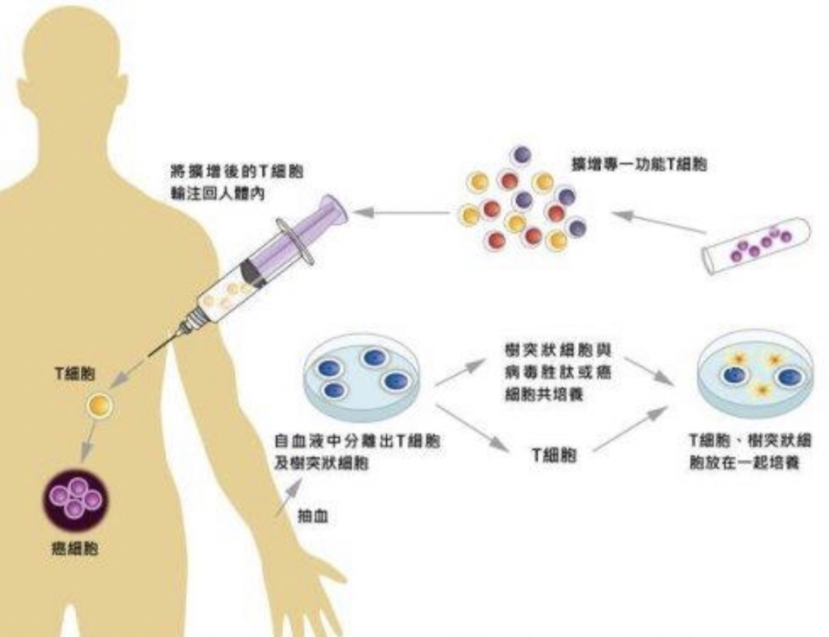 301醫院代診掛號服務慢病定期復查跟進，病情始終可控的簡單介紹