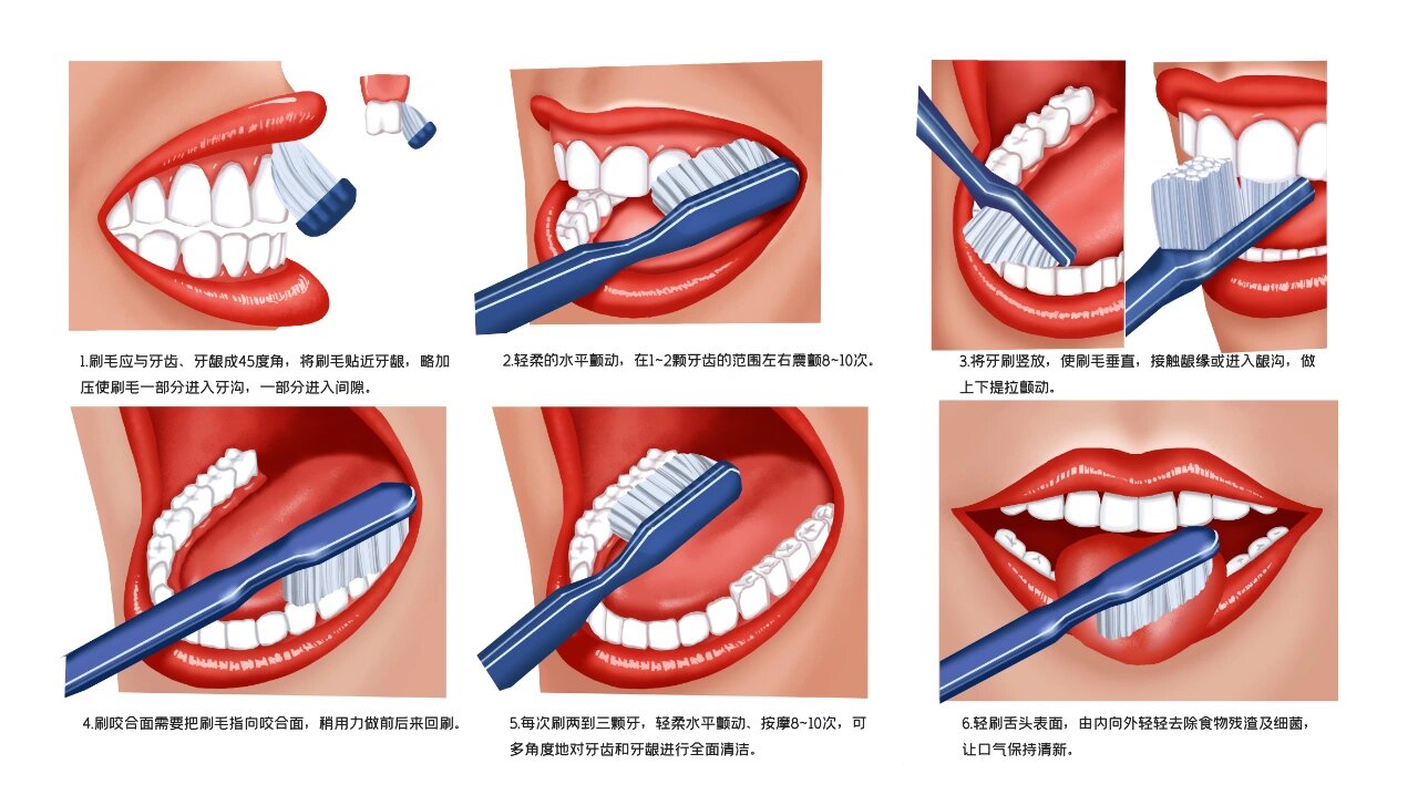 巴氏刷牙法图例 一般成年人推荐使用巴氏刷牙法刷牙.