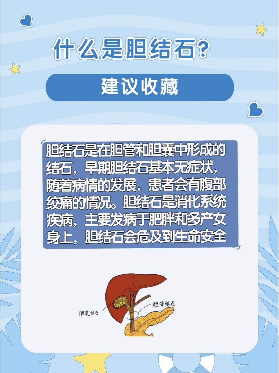 身体有这5个症状可能是胆结石哦~ 胆结石是在胆管和胆囊中形成的结石