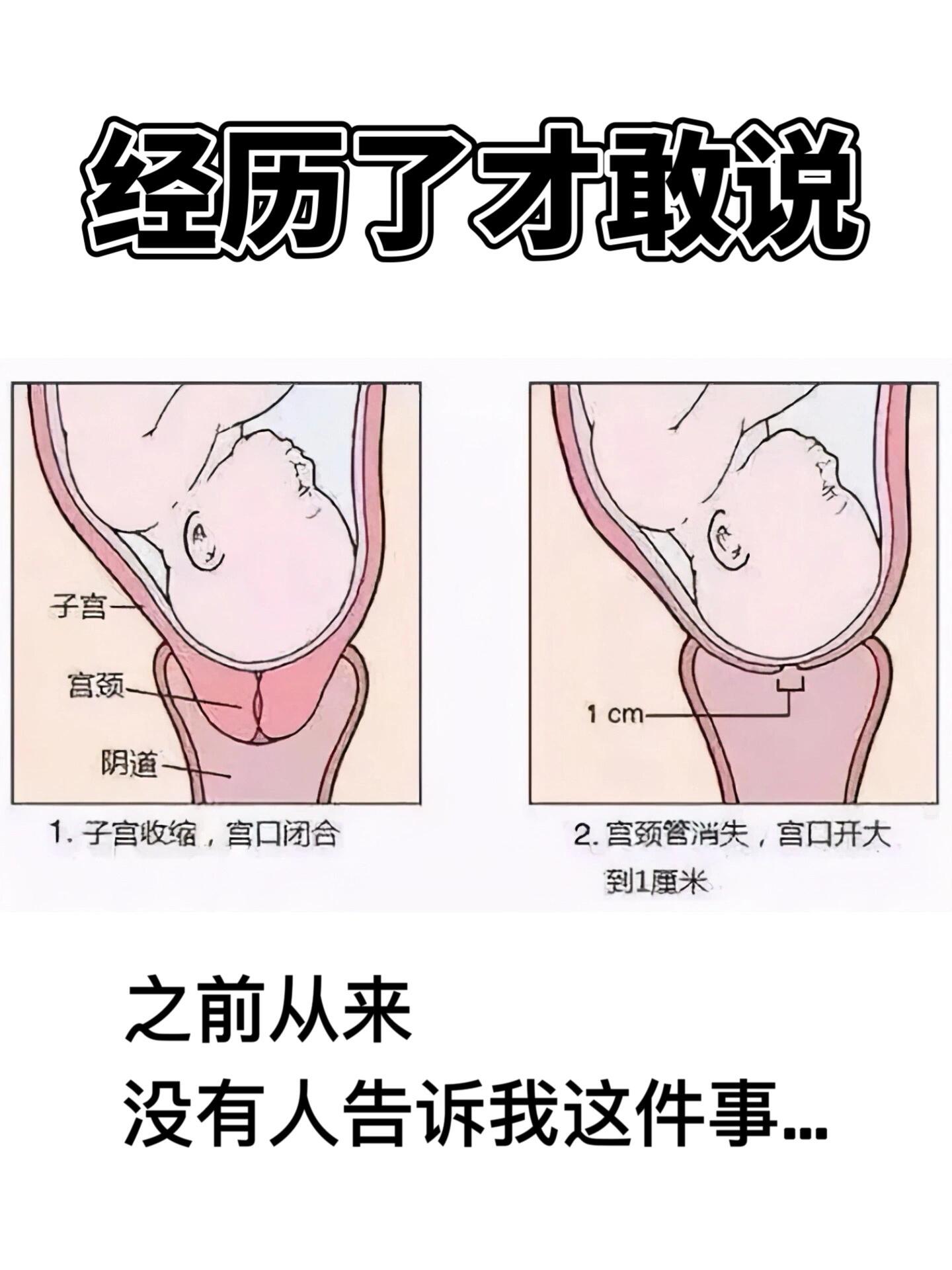 顺产后宫颈图片 区别图片