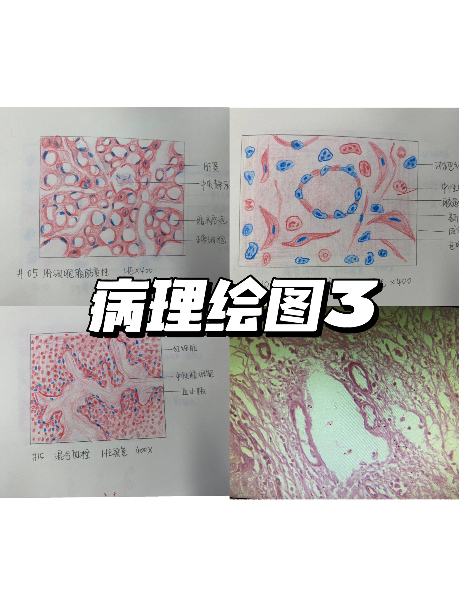 病理绘图手绘图图片