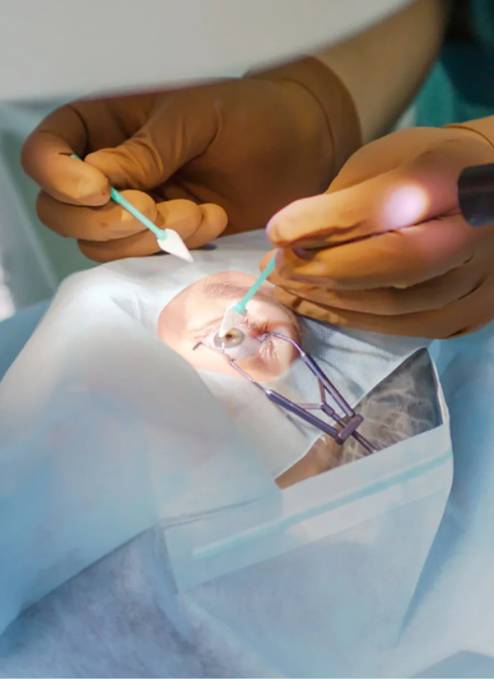 太田痣长到眼球上时,通常有几种处理方法