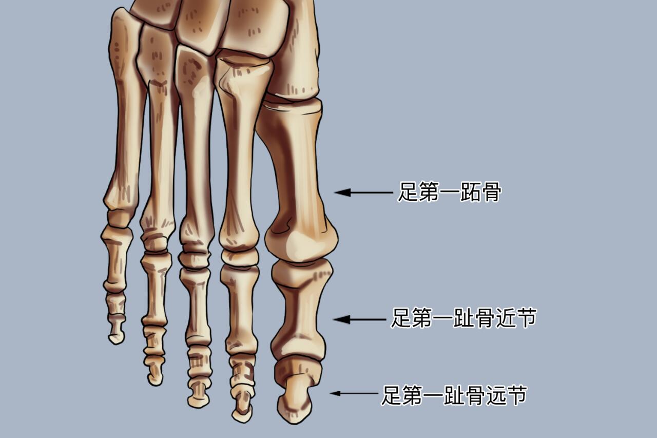 第一跖骨小头图片