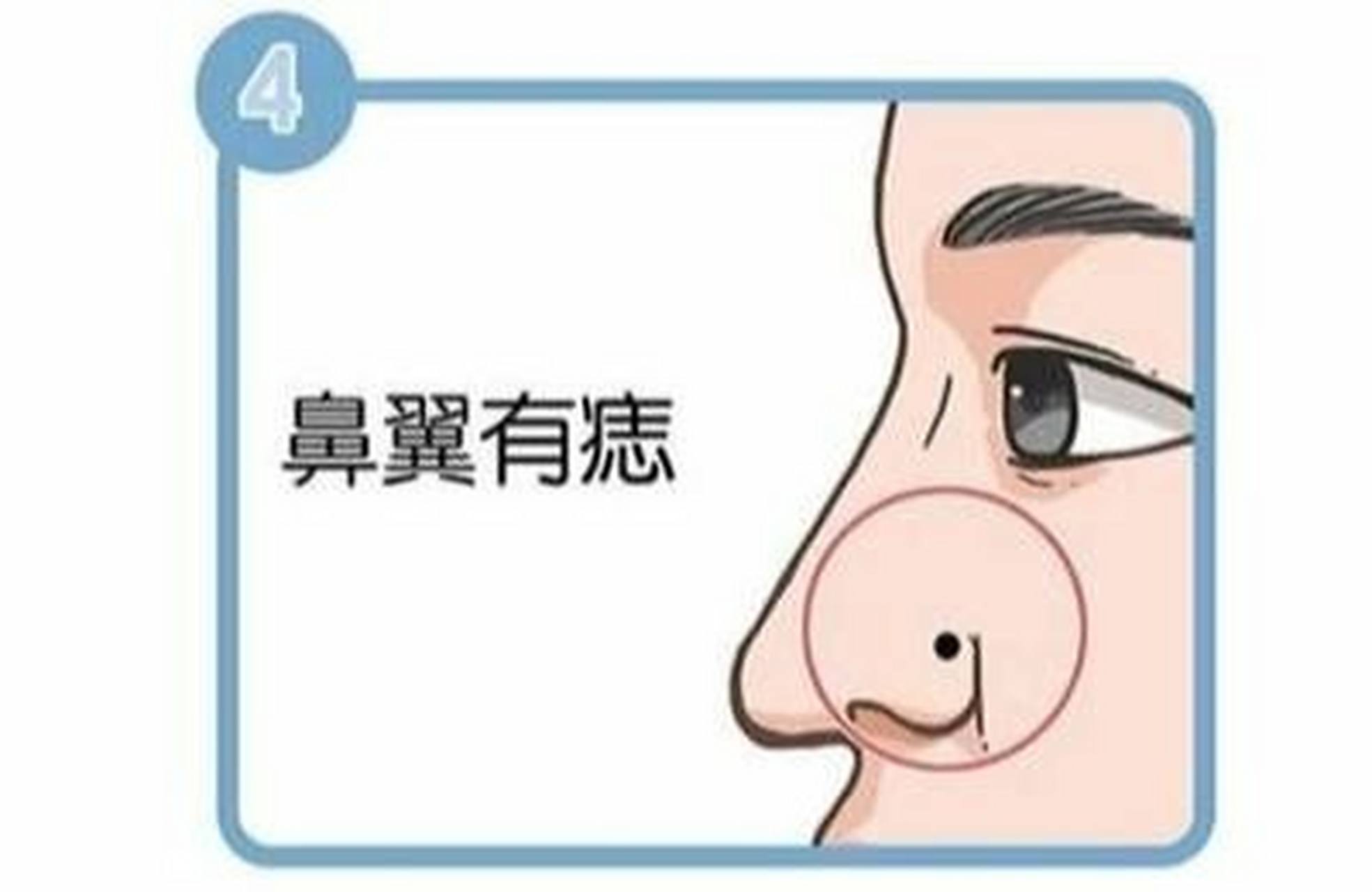 鼻翼旁边的痣代表什麽 鼻翼旁边如果有痣,那么代表本主在钱财的储存