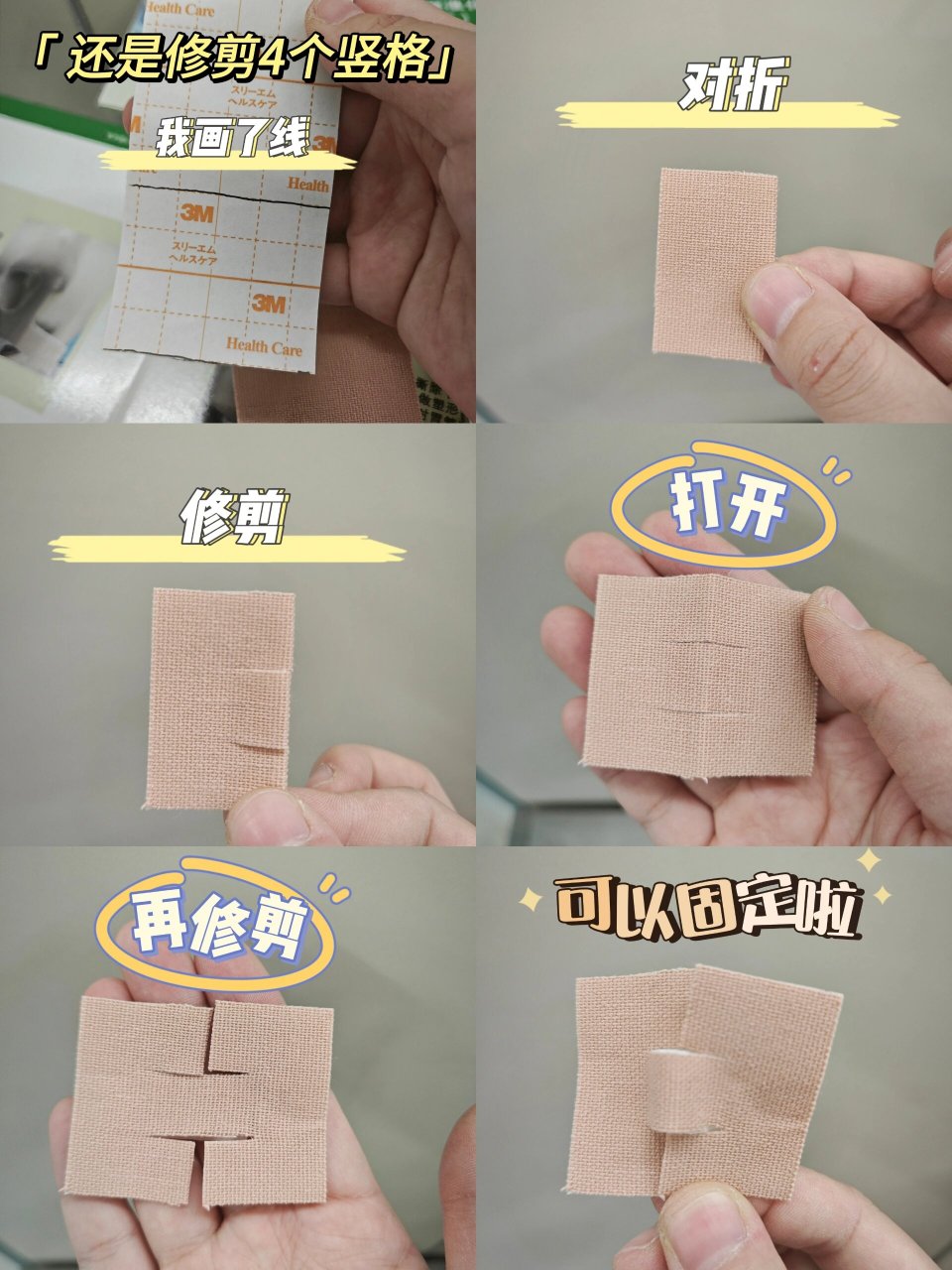临床胃管的固定方法 鼻肠管 enbd管 从鼻子出来的管子都可以这么固定