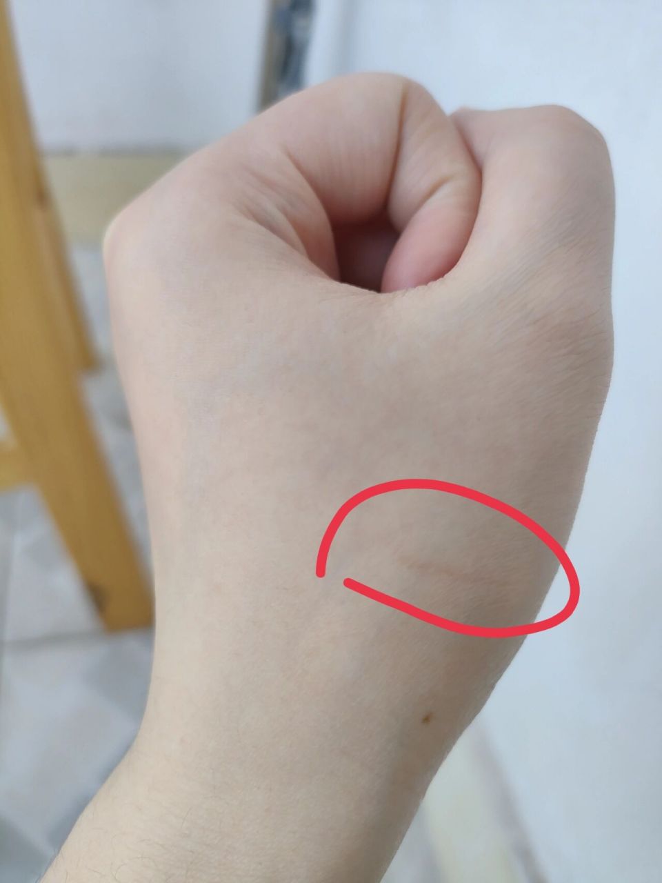 玩猫被咬到看起来没破皮要去打针吗 上午去玩猫了,不小心被咬到刚咬到