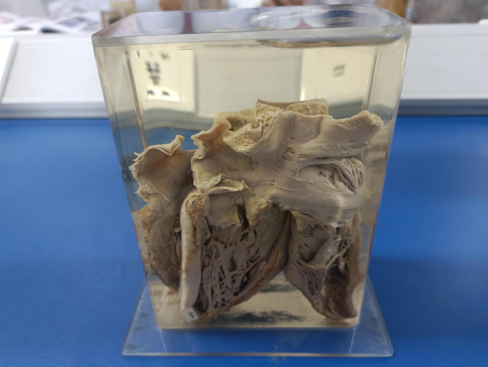 病理生理学大体标本学习 局部血液循环障碍 图1.