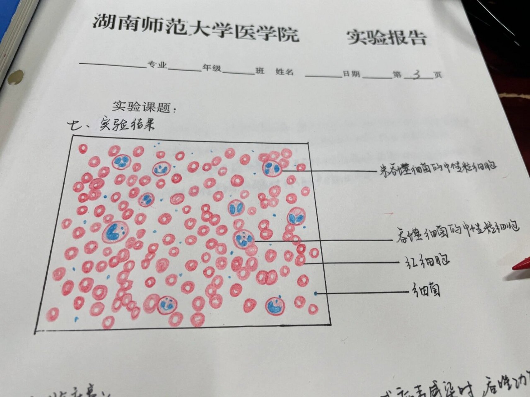 中性粒细胞吞噬图片