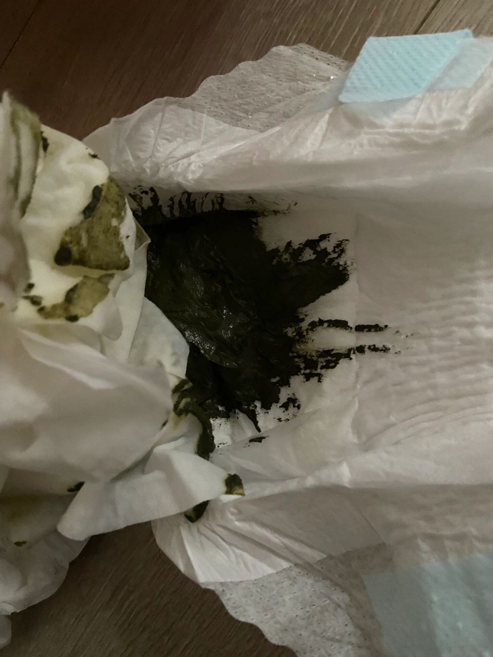 纽康特氨基酸奶粉之大便 最近几天总被宝宝的便吓死.颜色太深了.