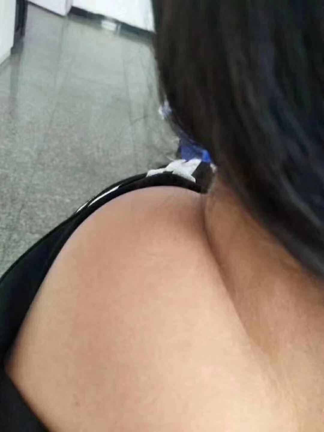 95  如果你发现颈椎地方凸起,或者在脖子后面长了一个大包,并且有