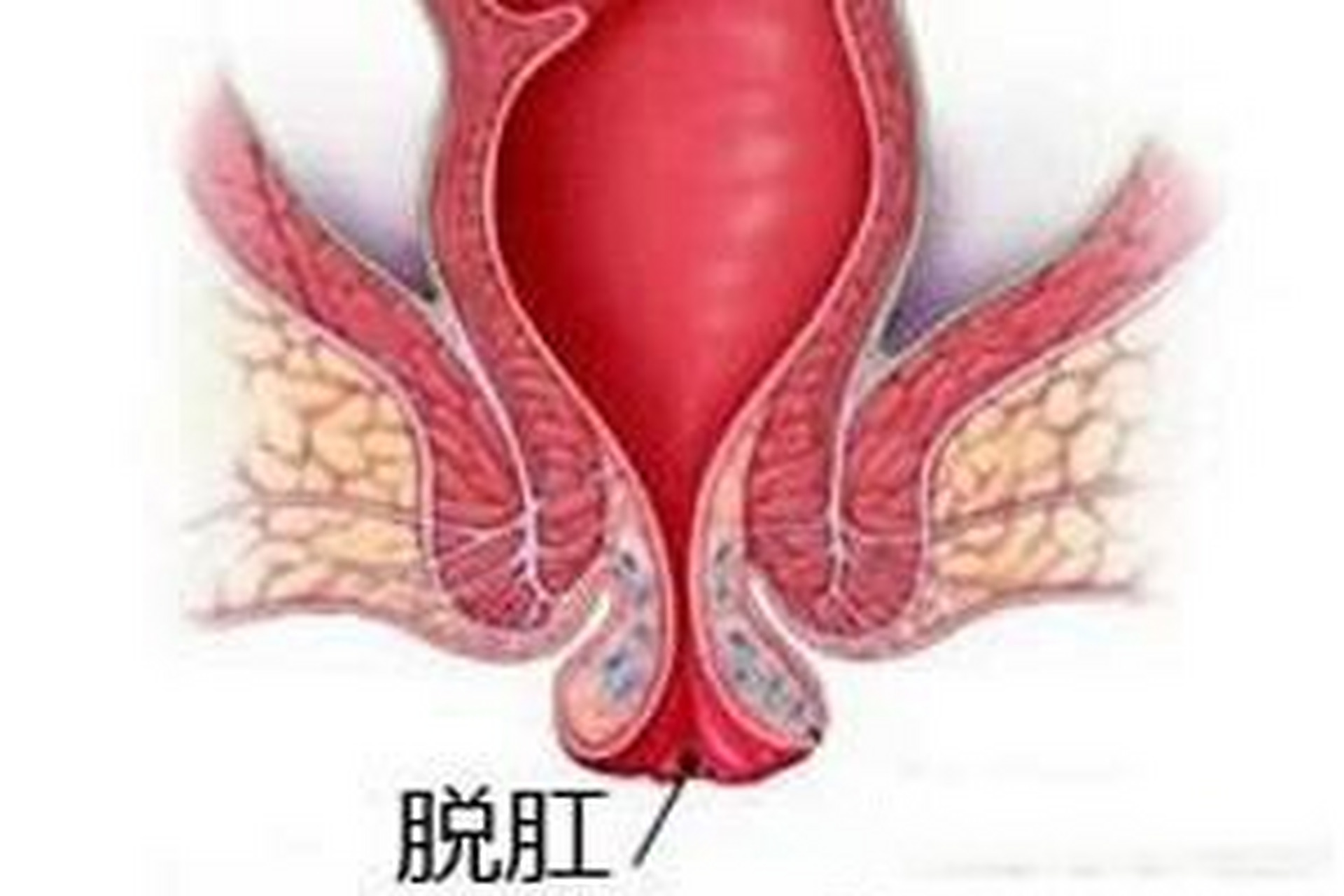 复兴中医肛肠:痔疮,脱肛,肛裂易诱发肛门松弛或肛管收缩性差 过节期间