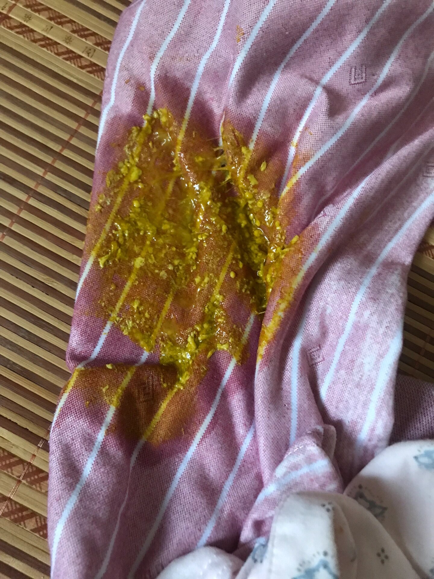 后面又是吃药又是换奶粉才好了. 五价轮状病毒疫苗,是一种预