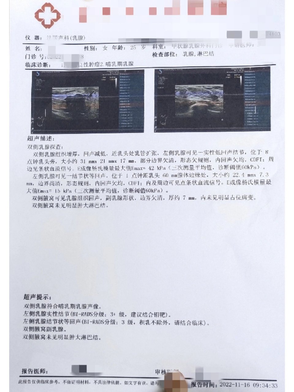 35岁以下,乳腺钼靶可能什么也发现不了 之前的一篇文章中我有说过不