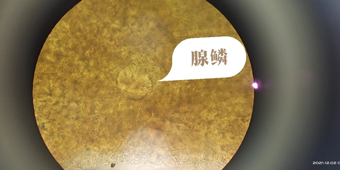 薄荷叶的粉末显微鉴别 1.腺鳞 2.非腺毛 3.腺毛 3.气孔我没找到