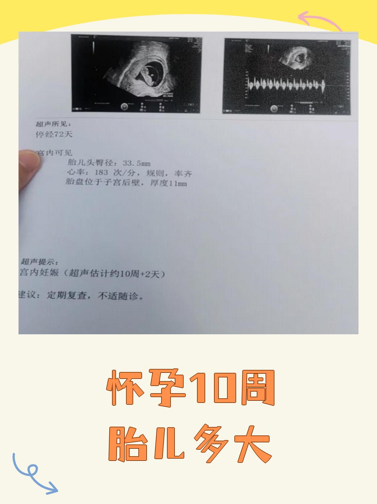 怀孕10周时胎儿长约3