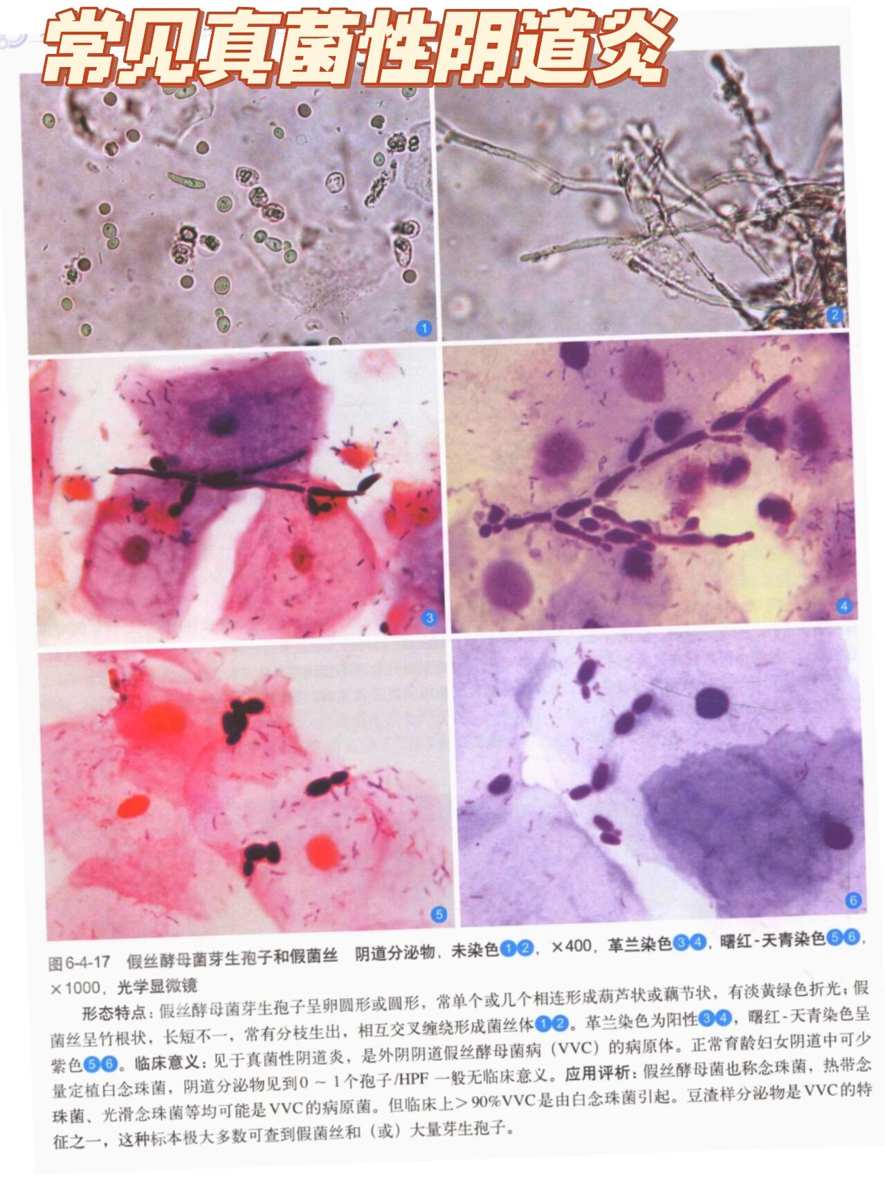 白带常规镜检图片教学图片