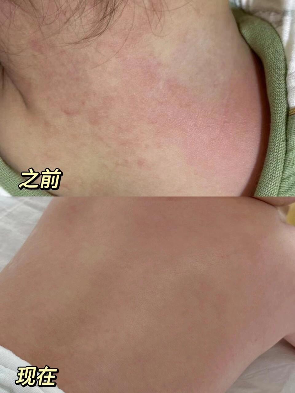 最近朋友送了一瓶安唯伊的抚触小金油,之前觉