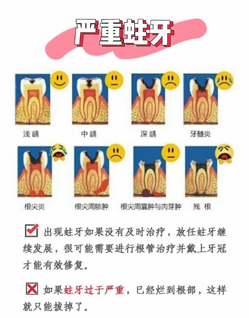 73怎样判断你的牙齿07是补还是做根管治疗呢 一般来说浅龋或者中