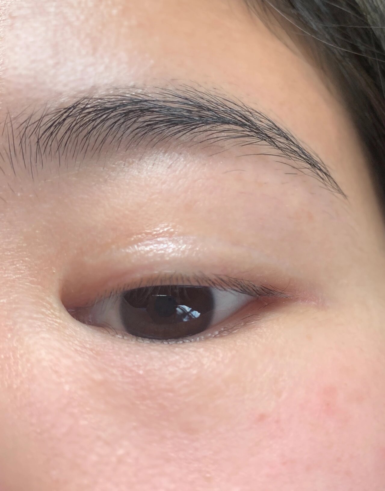 双眼皮出油正常吗 为什么双眼皮褶皱会出油啊?