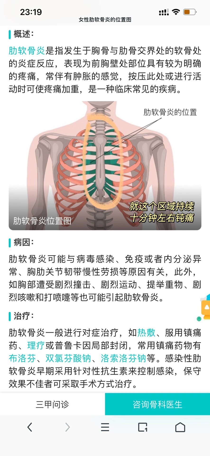 急性胸肋痛图片