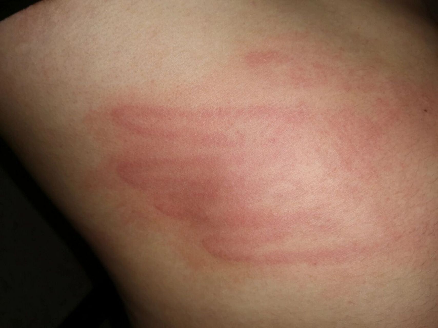 我试过了,小说里五指分明的巴掌印是真的 哈哈哈哈哈哈哈哈一整个大