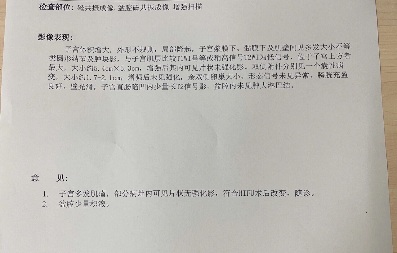 4*5.3cm 小刘,22岁,患多发性子宫肌瘤,最大超过五公分.