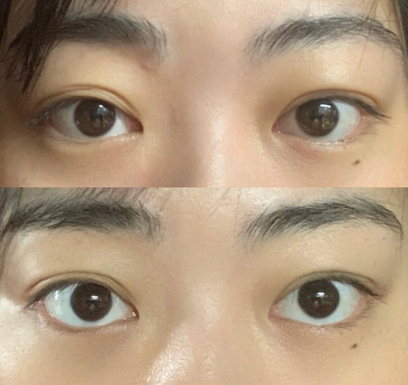 一觉醒来突然三眼皮了?