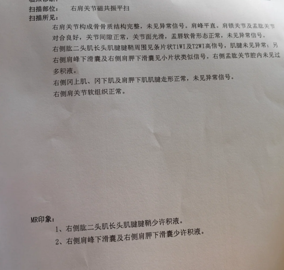 胳膊垂下来就疼,拿起来不疼,这种情况常见于运动不当,肌肉劳损,肩周炎