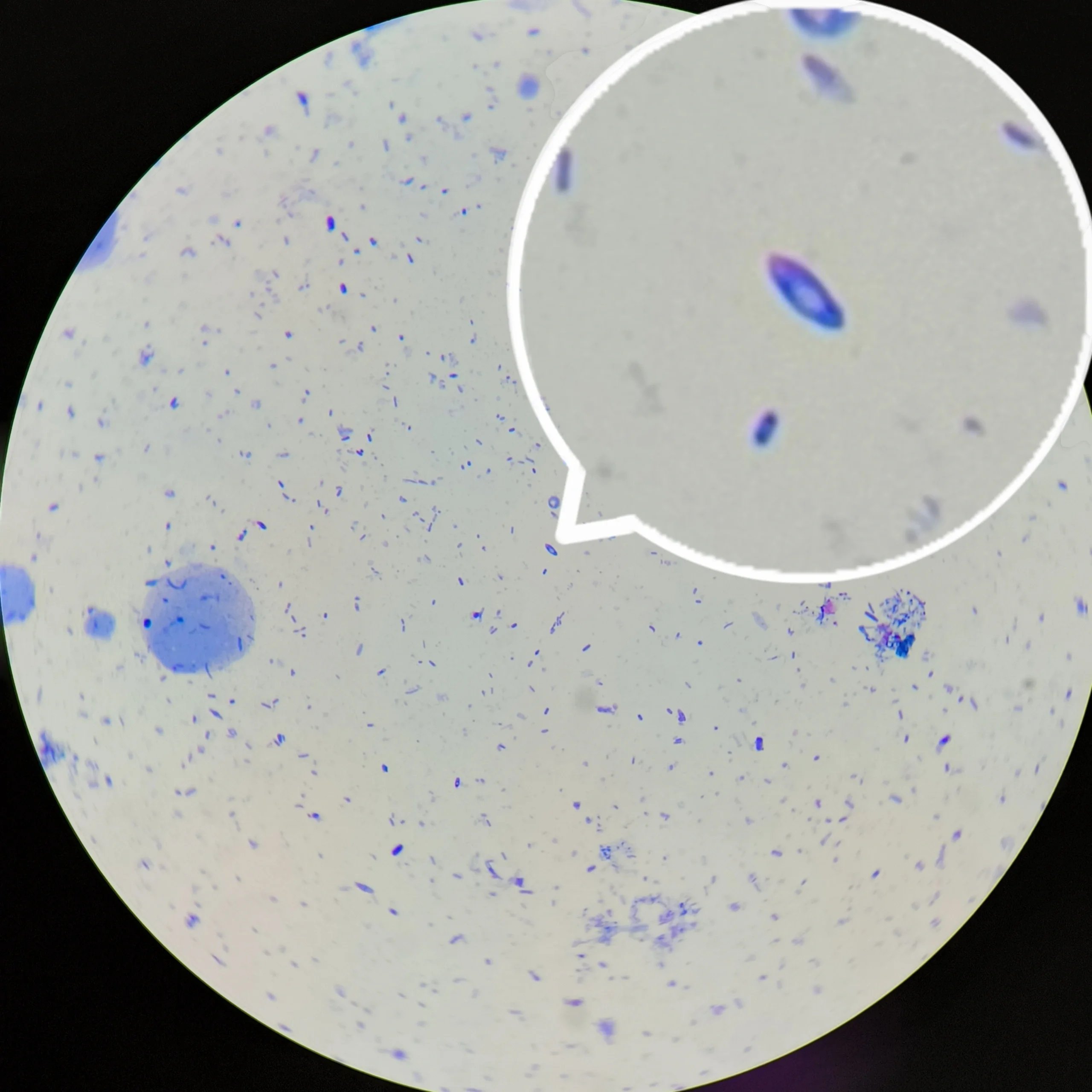 镜检〗芽孢杆菌产芽孢的位置与形态