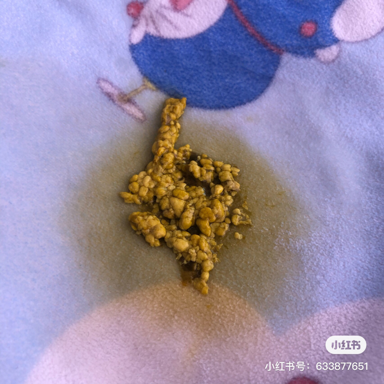 轮状病毒合并过敏性腹泻,内有便便图哦 宝宝腹泻,屁股红的老母亲看着