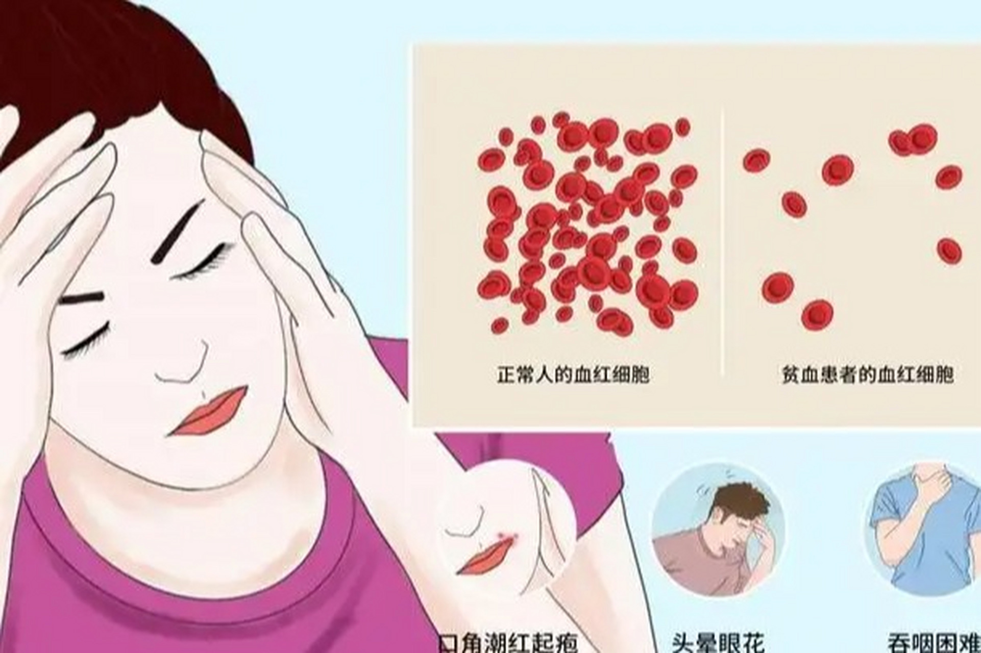贫血时,如果红细胞计数的下降程度低于血红蛋白浓度下降程度,就
