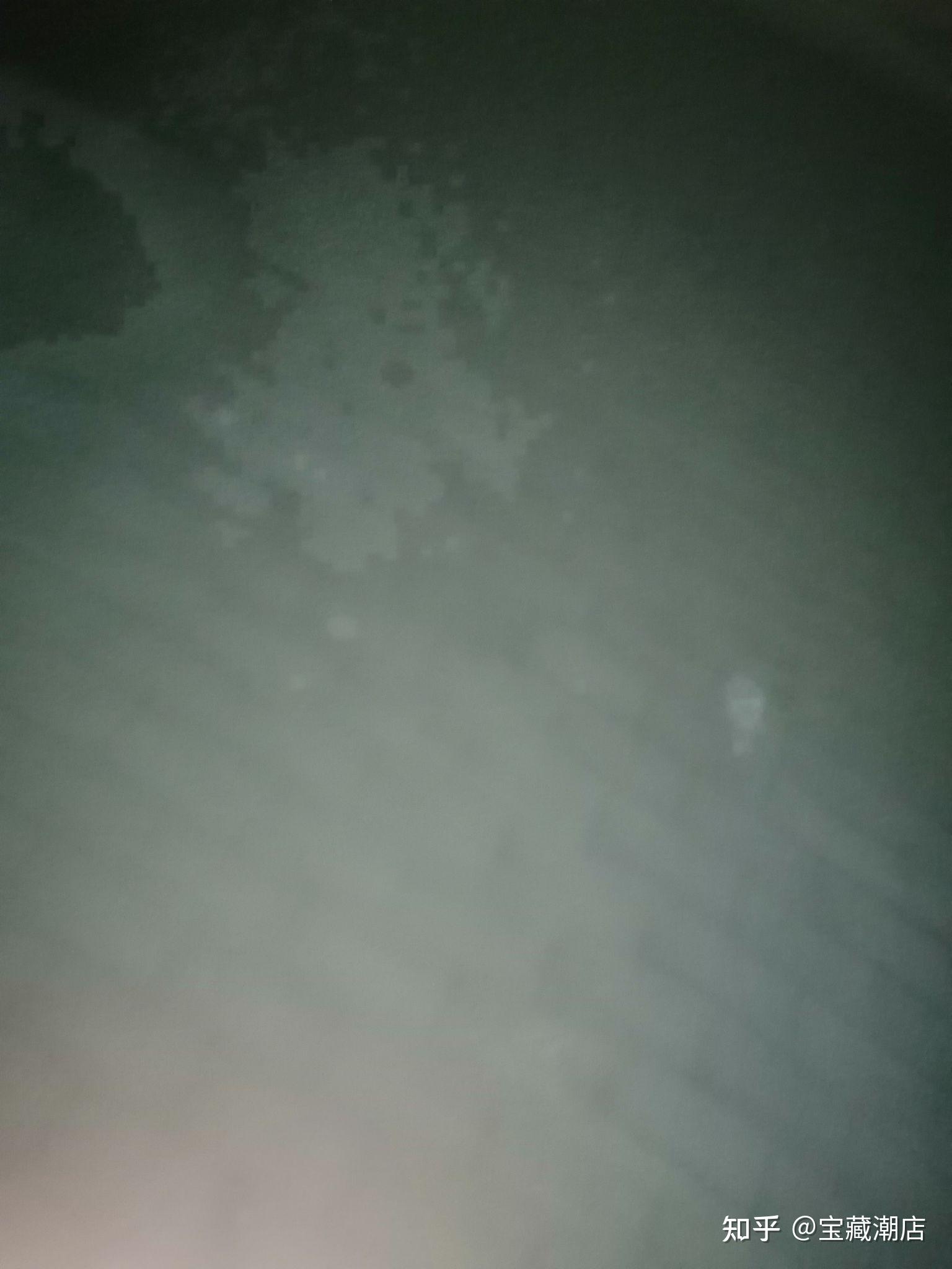 有没有尿急憋到憋不住的经历