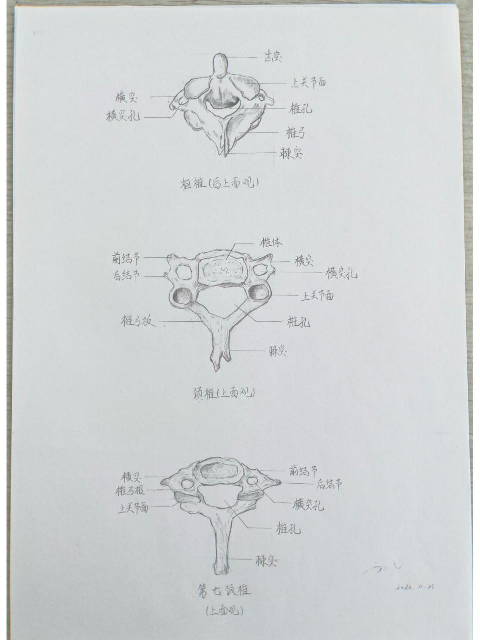 解剖学 颈椎寰椎与枢椎 11566寰椎,又称第一颈椎,是颈椎的第一节.