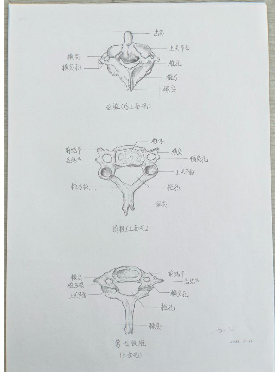 寰椎和枢椎解剖图手绘图片