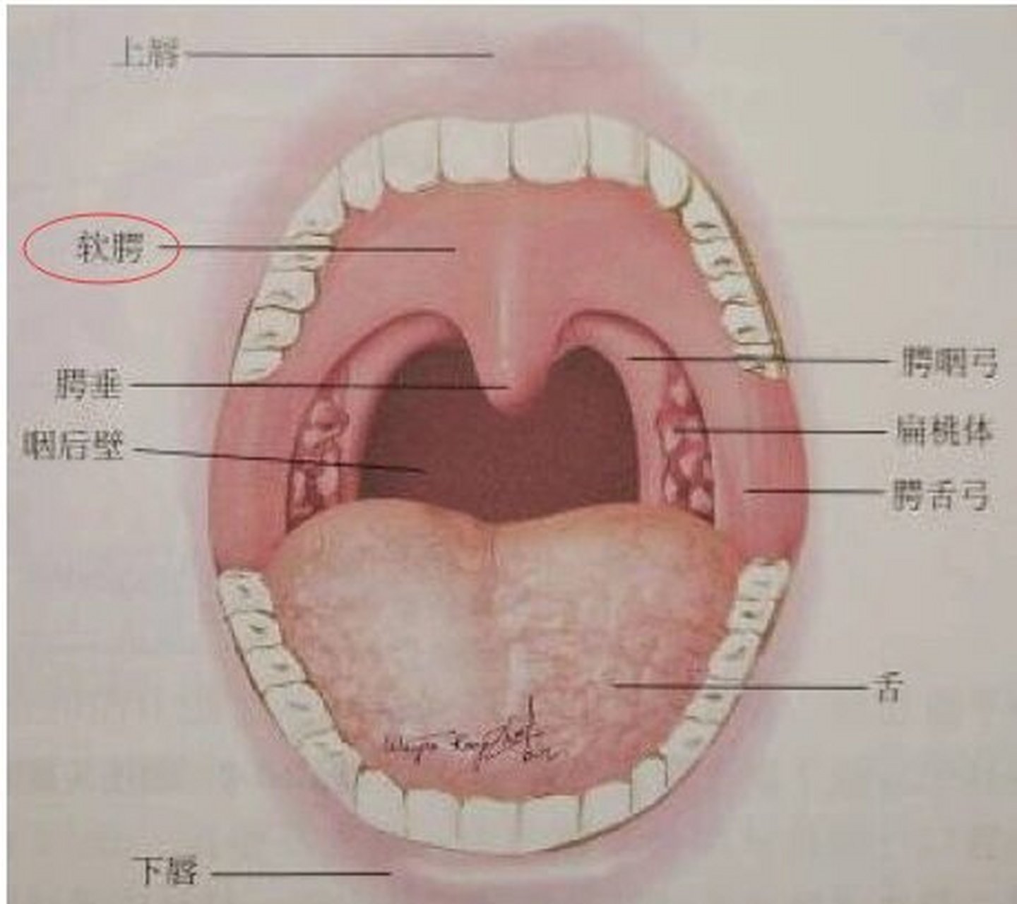 腭舌弓是哪里图片